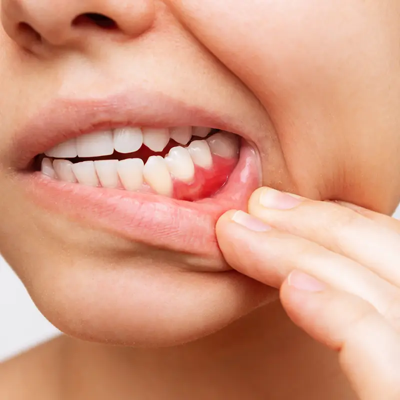 Periodontal Services